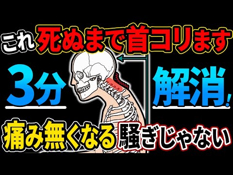 【知って得する】ストレートネックを根本的に改善する方法