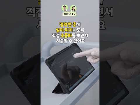 LIVE로 초음파 실리프팅은 어떻게 시술하나요?