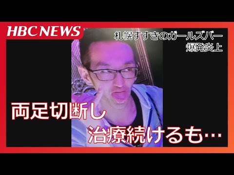 放火疑いの41歳男性、両足切断し治療続けるも容体回復せず死亡【札幌すすきのガールズバー火災】警察は容疑者死亡のまま書類送検する方針