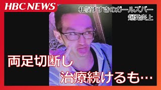 放火疑いの41歳男性、両足切断し治療続けるも容体回復せず死亡【札幌すすきのガールズバー火災】警察は容疑者死亡のまま書類送検する方針