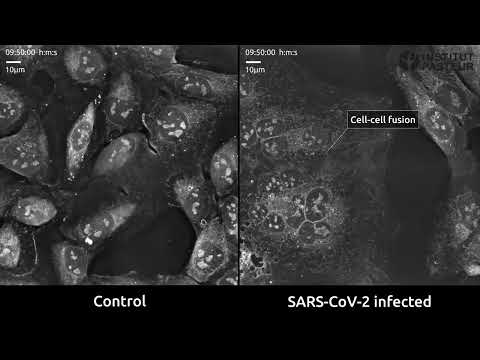 Cell-to-cell fusion: the key to COVID-19 infection?