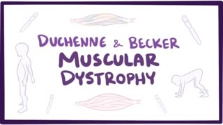 Duchenne & Becker muscular dystrophy - causes, symptoms, treatment & pathology