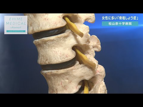 「骨粗しょう症～女性に多い骨粗しょう症篇～」EHIME MEDICAL channel 4月4日予告