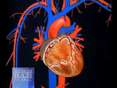 Detecting Heart Disease with Calcium Score - Scottsdale Medical Imaging