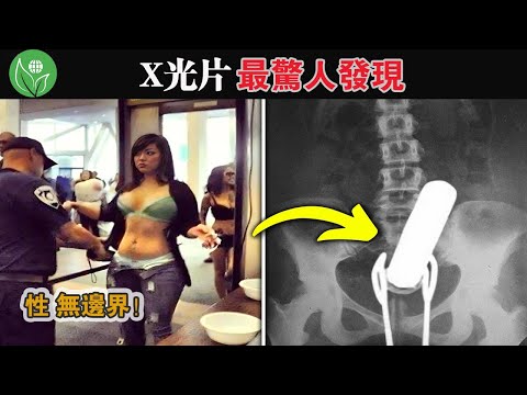 年輕人玩的真花！安檢時發現一根「巨棍」 ，卡在女性下體！ X射線發現的 15 件最奇怪事物。 # 探索旅行號 #排名 #冷知識 #top10  #世界之最 #地球最TOP #X光片