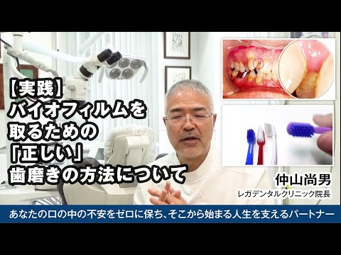 【実践】バイオフィルムを取る「正しい」歯磨きの方法