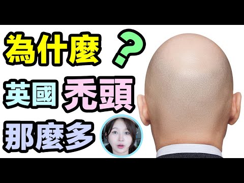 為什麼英國那麼多禿頭？ ？原來吃肉會脫發？ ？Why so many bald man in UK？？