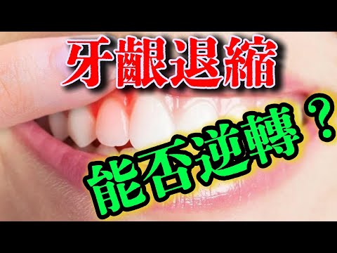 牙齦退縮：能否逆轉？