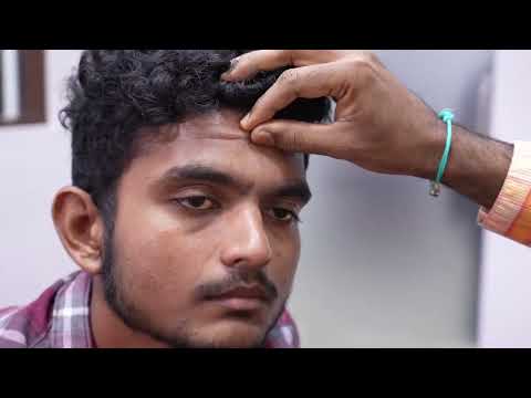 Treating a Depressed Scar on the Forehead | Doctor Consultation