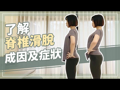 久坐族高危險群注意!了解脊椎滑脫成因及症狀｜詹珞瑤 物理治療師 Veronica Rehab