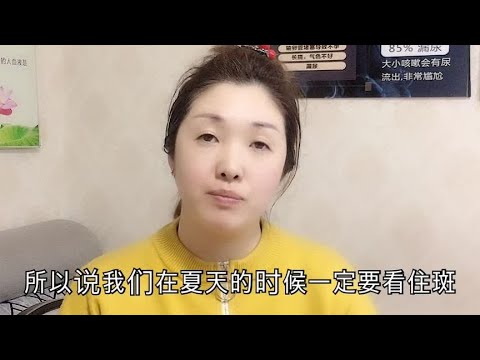 夏季补水，控制返斑，抑制皱纹