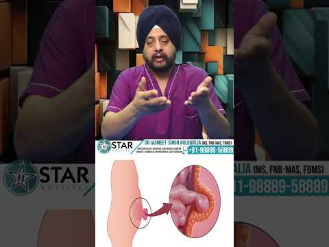 Kya Hernia Dobara ho skta hai? How to Minimize its Chances of Recurrence | Hernia Surgery Tips