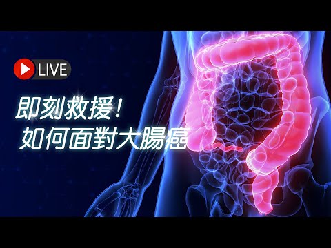 即刻救援! 如何面對大腸癌 | James On Air