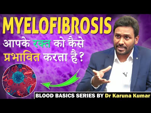 Myelofibrosis symptoms and Treatment | मायलोफाइब्रोसिस  | Dr. Karuna Kumar