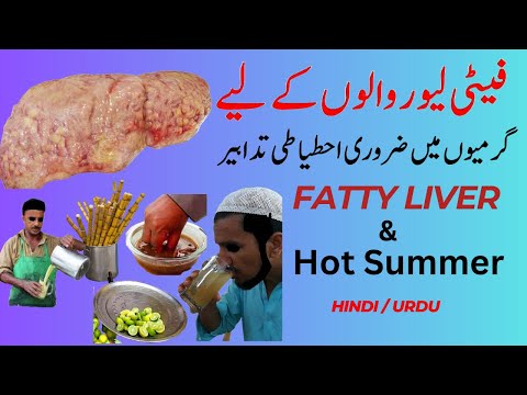 Precautions for Fatty Liver Patients in Hot Weather: Essential Tips for a Healthy