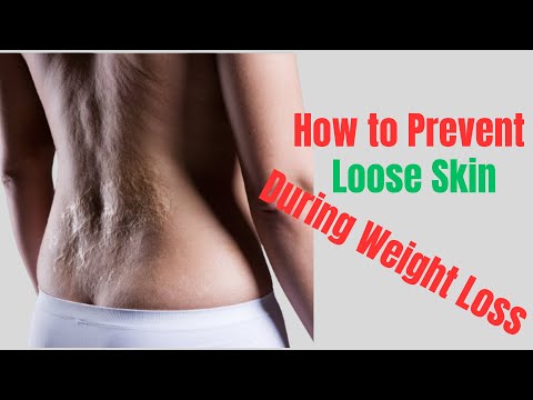 How To Prevent Loose Skin During Weight Loss - Loose Skin