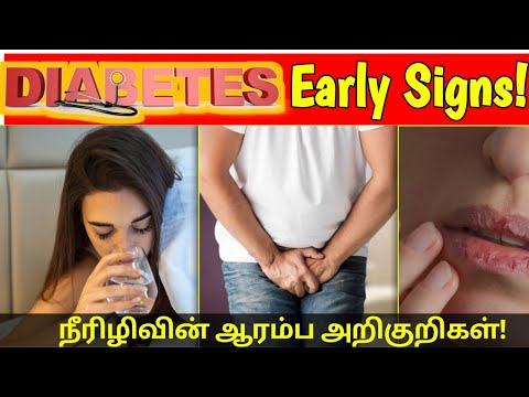 நீரிழிவின் ஆரம்ப அறிகுறிகள் | Early signs of diabetes in tamil | STAR LABORATORY