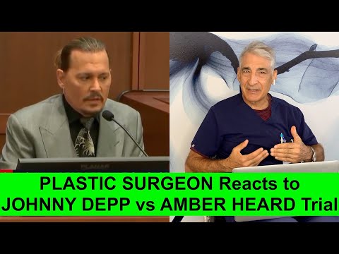 Plastic Surgeon REACTS to JOHNNY DEPP FINGER AMPUTATION in Amber Heard Defamation Trial!