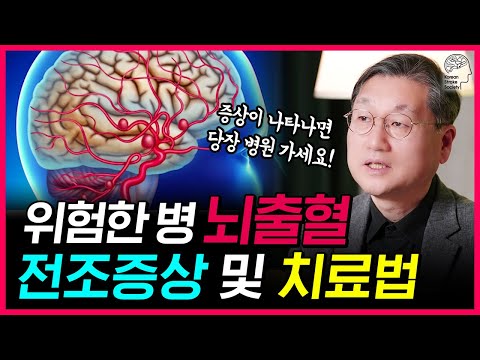 도끼로 머리를 찍는 듯한 두통에 시달린다면?! l ‘뇌출혈’ 진단과 치료법