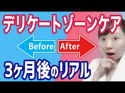 【女医がレビュー】理想のデリケートゾーンケア！_ ビフォーアフターを解説！【黒ずみケアのリアル】