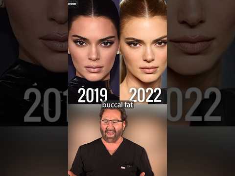 Kendall Jenner’s New Look | Plastic Surgeon Reacts