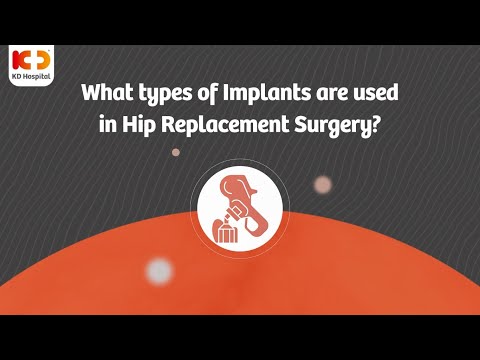 Dr Ateet Sharma | Types Of Implants | Hip Replacement | KD Hospital