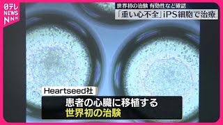 【「重い心不全」iPS細胞で治療】世界初の治験…有効性など確認  慶応大学名誉教授が発表