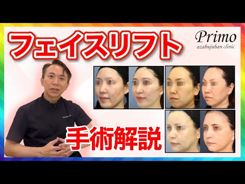 フェイスリフト切開リフトってどんな手術？どこがかわるの？医師が解説★☆美容整形・輪郭☆★