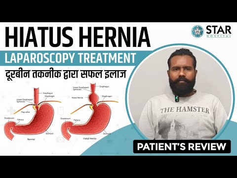 Best Hiatus Hernia Hospital In Ambala | Best Hiatus Hernia Treatment In Ambala | Best Doctor