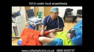 Endovenous Laser Ablation for Varicose Veins, UK