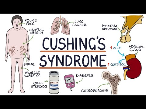 Understanding Cushing's Syndrome