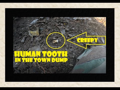 Town Dump Archaeology - Human Tooth - Bottle Digging - Oddities - Antiques - Marbles - Toys - Makeup