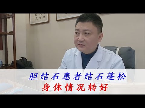 胆结石患者结石逐渐蓬松身体状态变好