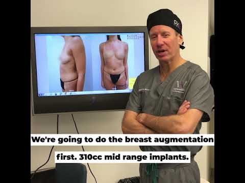 Breast Augmentation and Rhinoplasty Combo Surgery