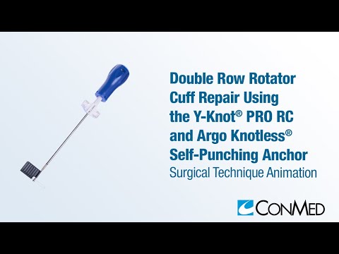 Double Row Rotator Cuff Repair Using Y-Knot® PRO RC and Argo Knotless® Self-Punching Anchor - CONMED