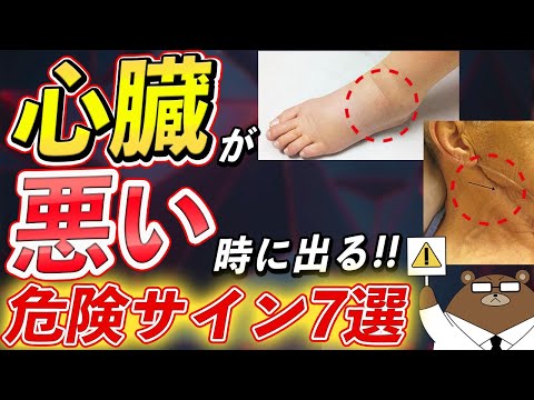 放置厳禁！絶対に見逃さないで！知らないと後悔する心臓が悪い時に出る危険な7つの症状とは？