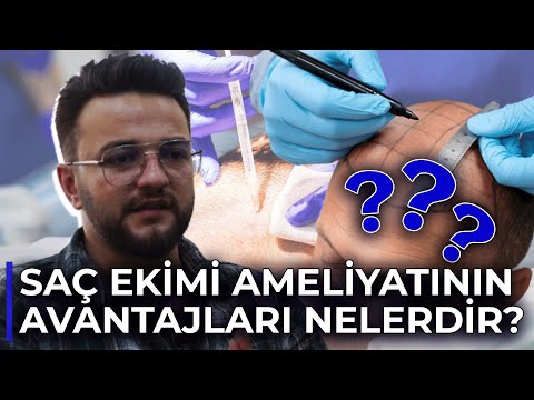 Saç Ekimi Ameliyatları ve Avantajları