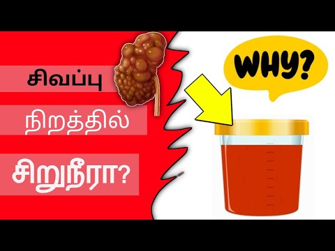 சிவப்பு நிறத்தில் சிறுநீர்/why urine comes in red colour/urine red colour symptoms in tamil