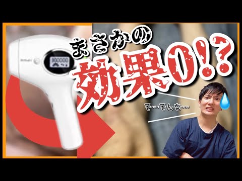 【Bosidin ボシディン】家庭用脱毛器を1年使ってから2年間放置してみたら…【日本化粧品検定1級保有の美容オタクによる忖度一切なし結果発表】