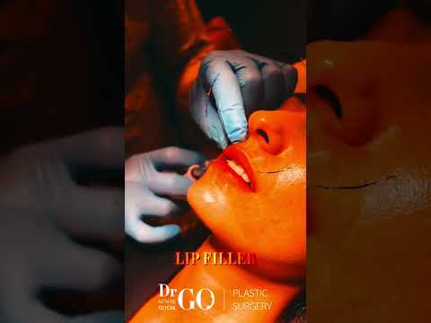 Lip Filler Treatment - Dr. Guncel Ozturk #drgo #guncelozturk