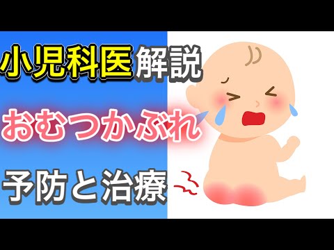 赤ちゃんのおむつかぶれの予防から治療方法まで小児科医が全て伝授します