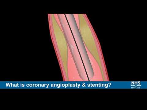 Stent Used for Coronary Artery Disease