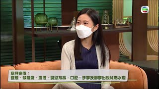 【TVB流行都市訪問】手足口病  兒科專科徐梓筠醫生 2022 09 01