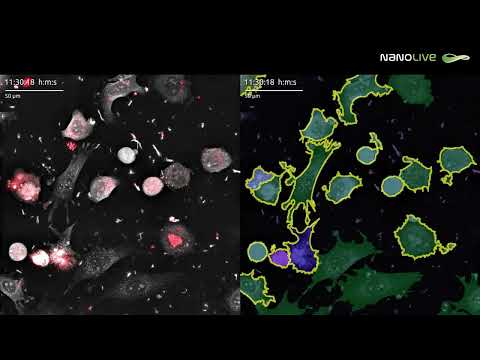 Killing of cancer cells detected by the LIVE Cytotoxicity Assay