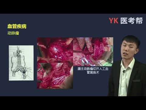 第四十五章 周围血管与淋巴管疾病 02 血管疾病（动脉瘤、原发性下肢静脉曲张）