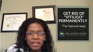 How to Cure #Vitiligo | Get Rid of it Permanently | Does Natural Treatment Really Work? |