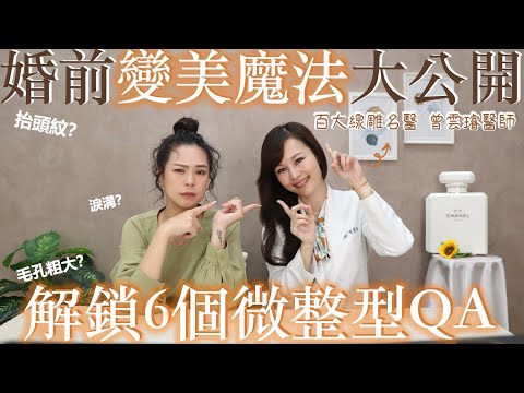 解鎖6個微整QA🔒｜婚前變美魔法大公開✨