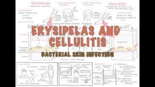 Bacterial Skin Infection - Cellulitis and Erysipelas (Clinical Presentation, Pathology, Treatment)