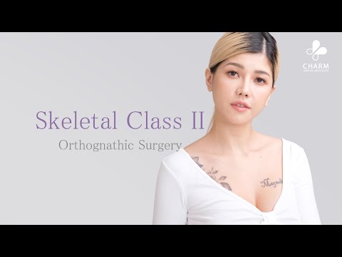 Skeletal Class II Orthognathic Surgery