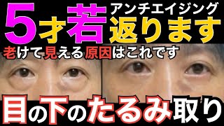 50代【必見】アンチエイジング「くま取り、目の下のたるみ」痛くない！コスパ最強！切らない！老け見えの原因